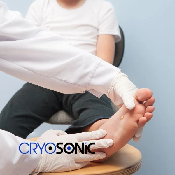 Are you looking for fast effective wart removal Contact us today Earl Shilton